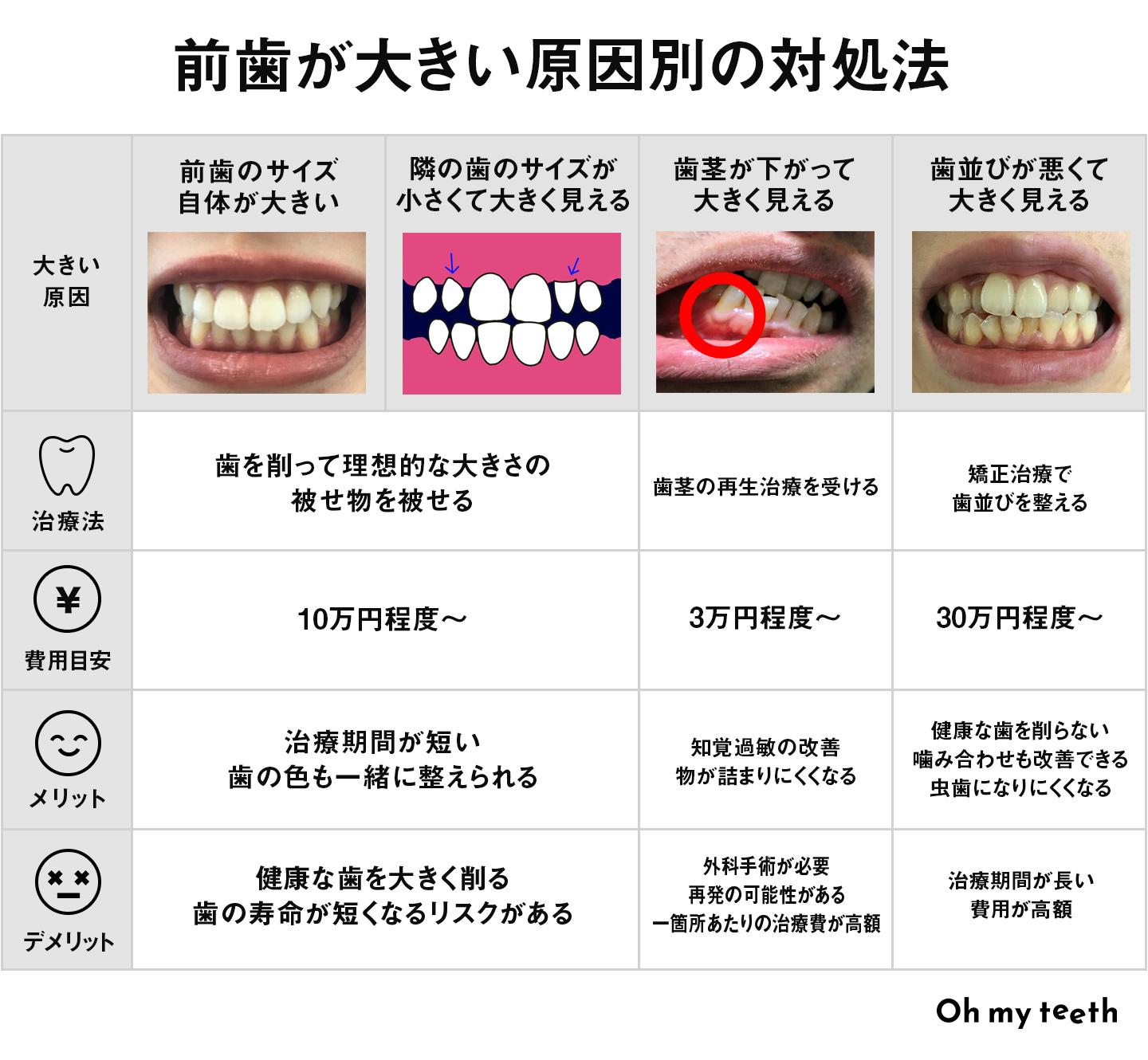 前歯が大きい原因別の対処法