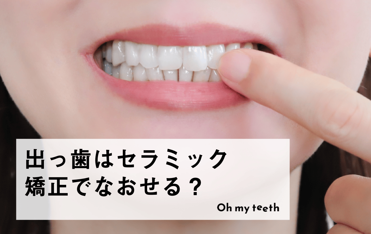 出っ歯はセラミック矯正で治せる？