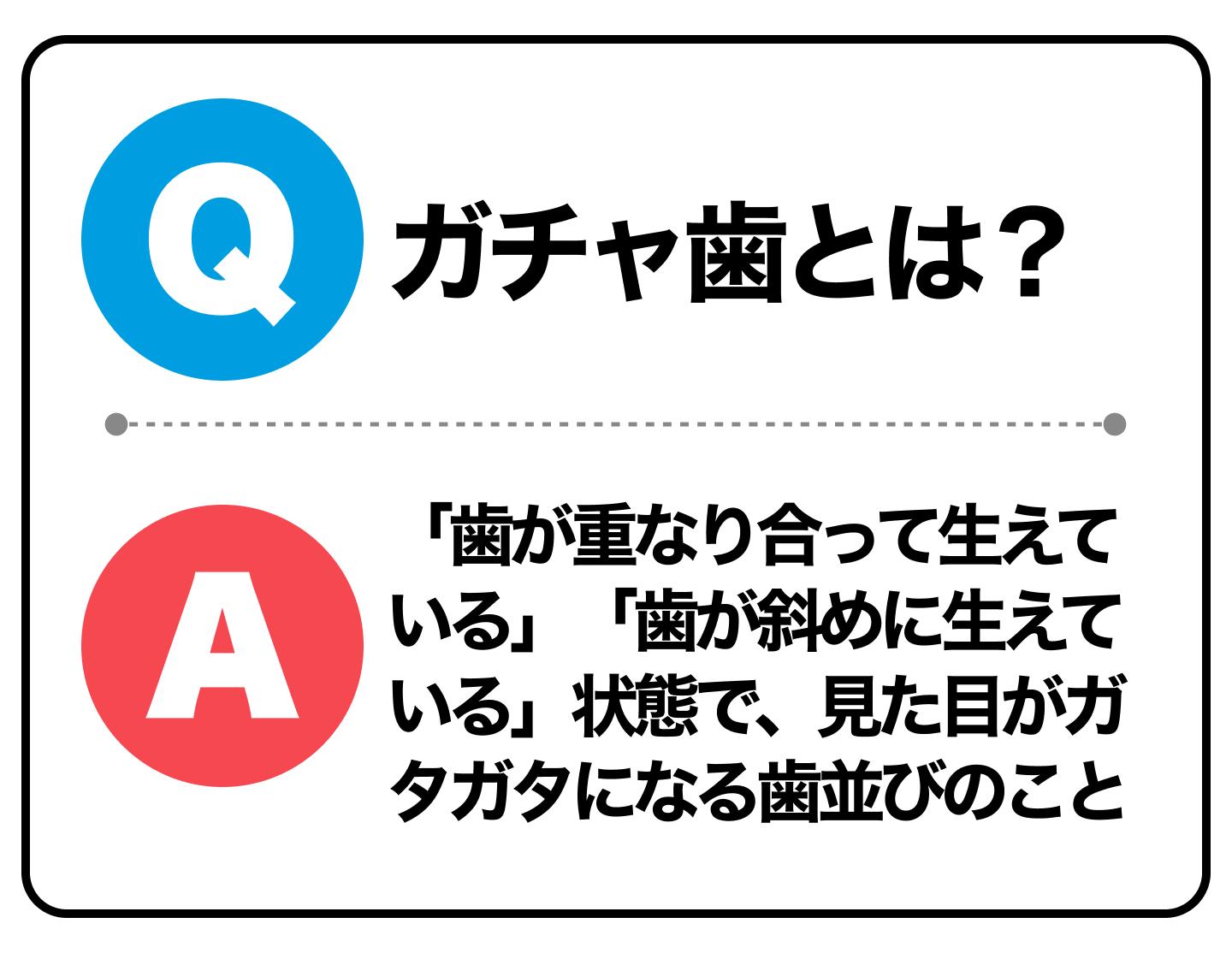 ガチャ歯とは?
