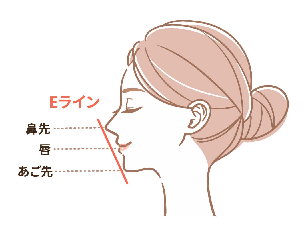 Eライン矯正