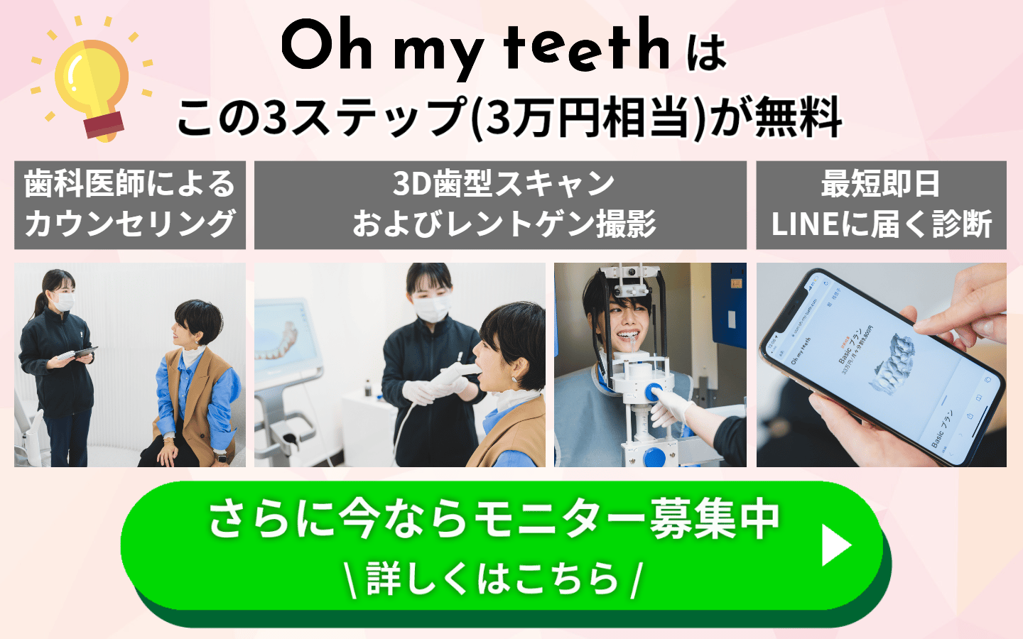 Oh my teethはこの3ステップ(3万円相当)が無料