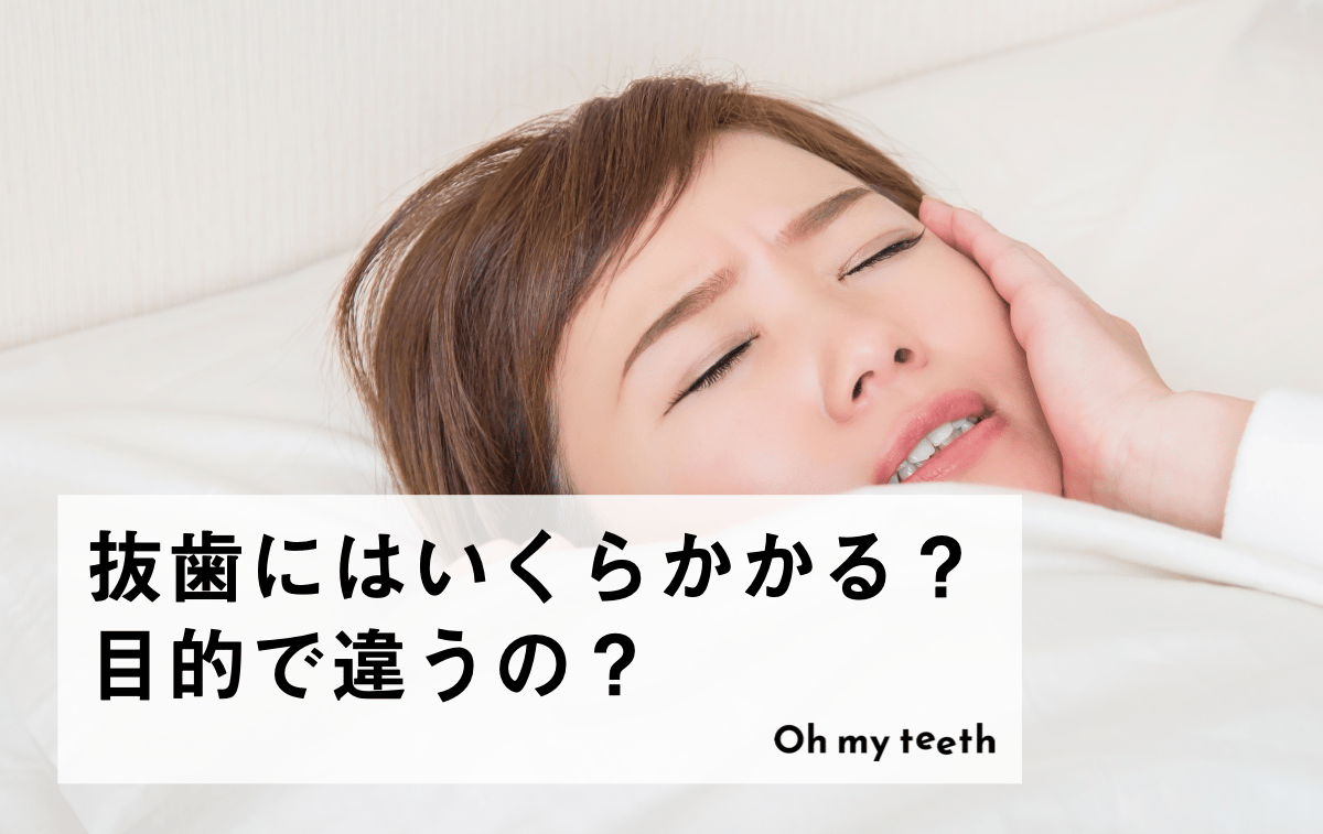 抜歯の費用はいくら？