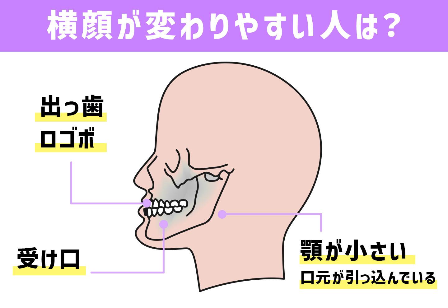 横顔はキレイになる例