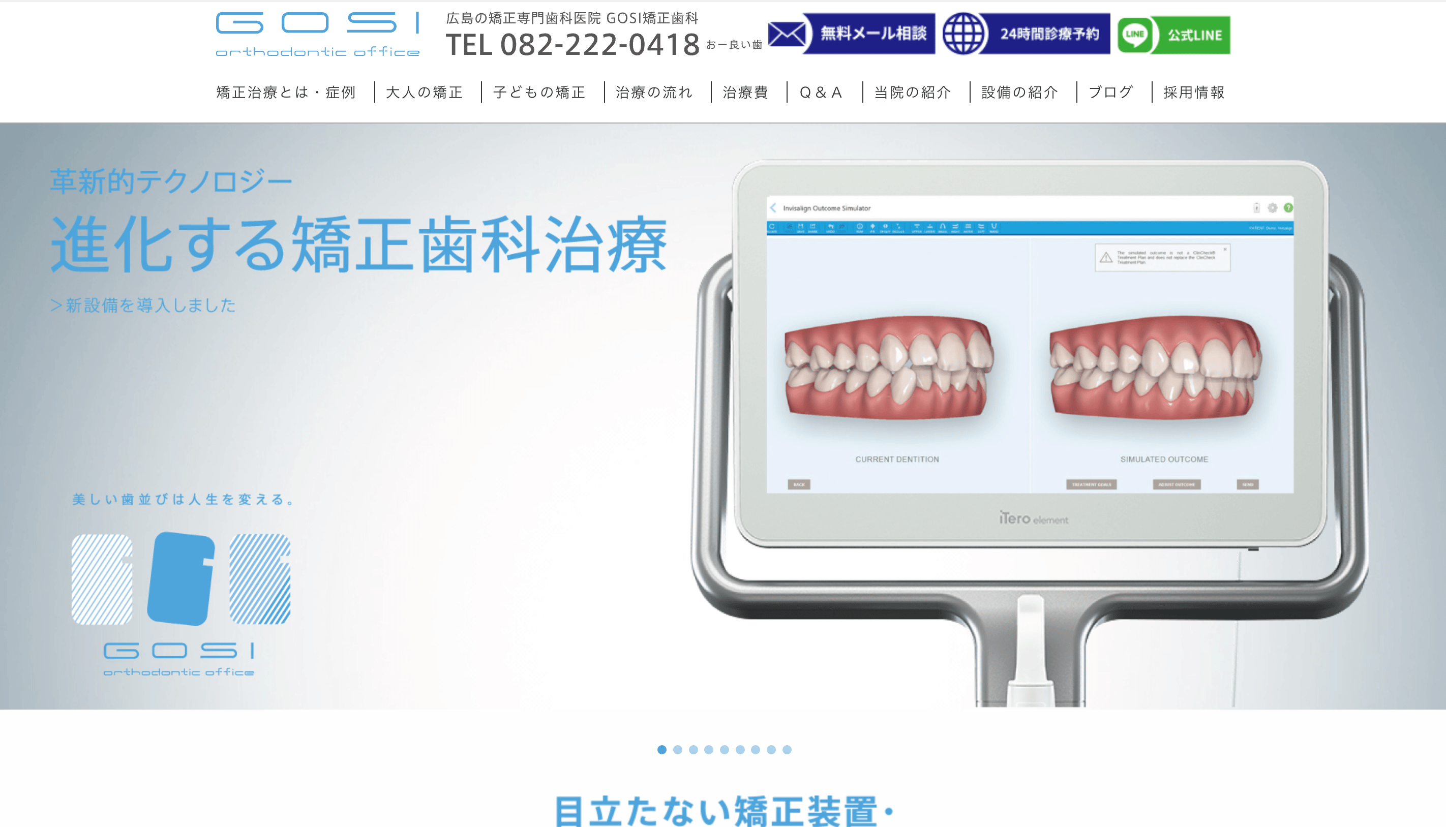 GOSI矯正歯科