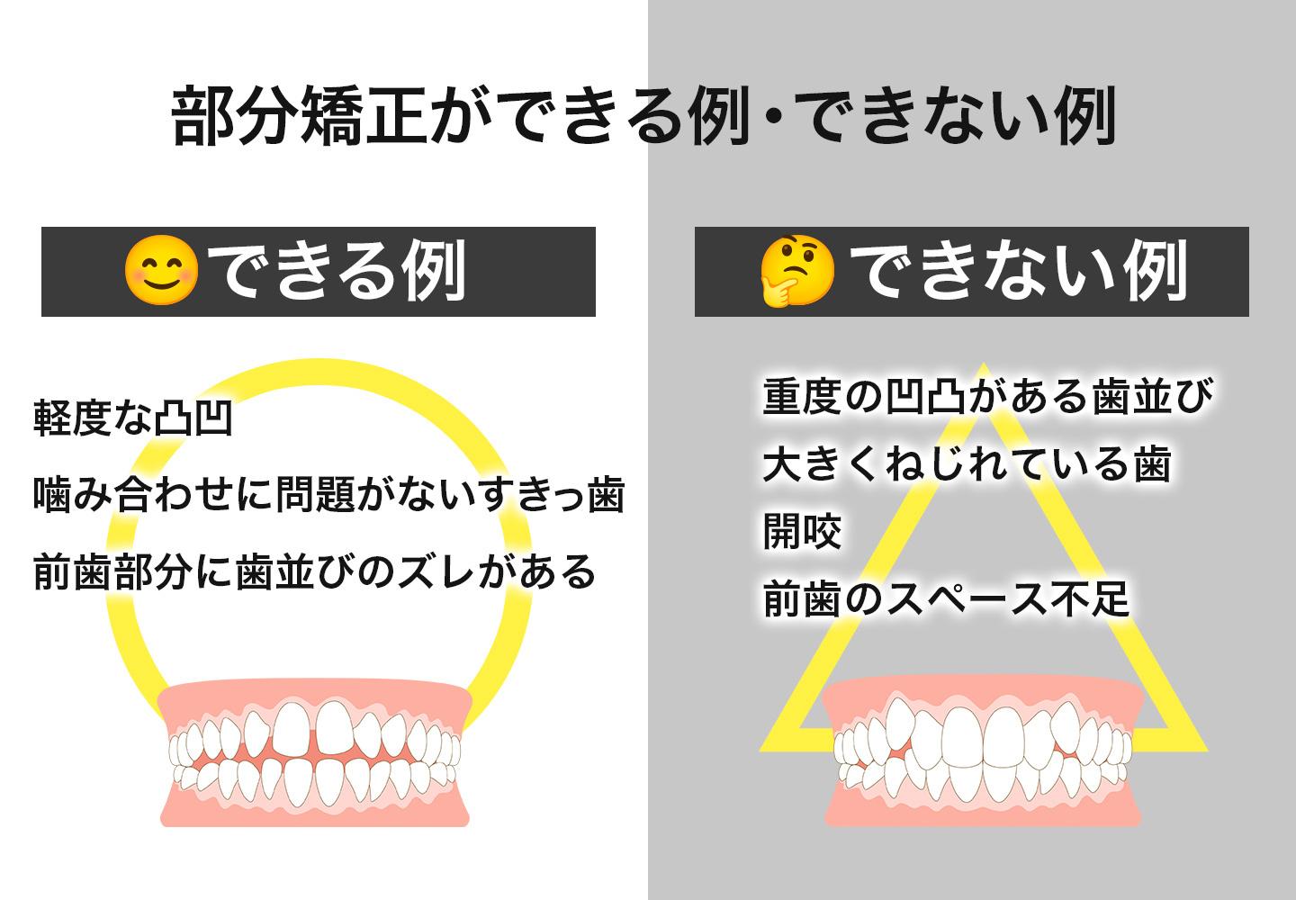 部分矯正ができる例・できない例