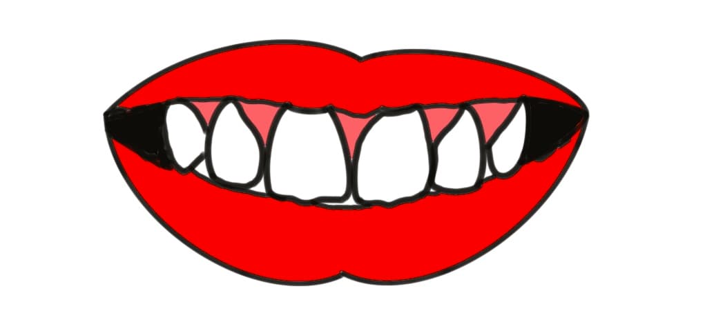 【歯学博士が解説】お笑いコンビ “ダイアン” の津田篤宏さん 「歯が多い」と言われるのはなぜ？