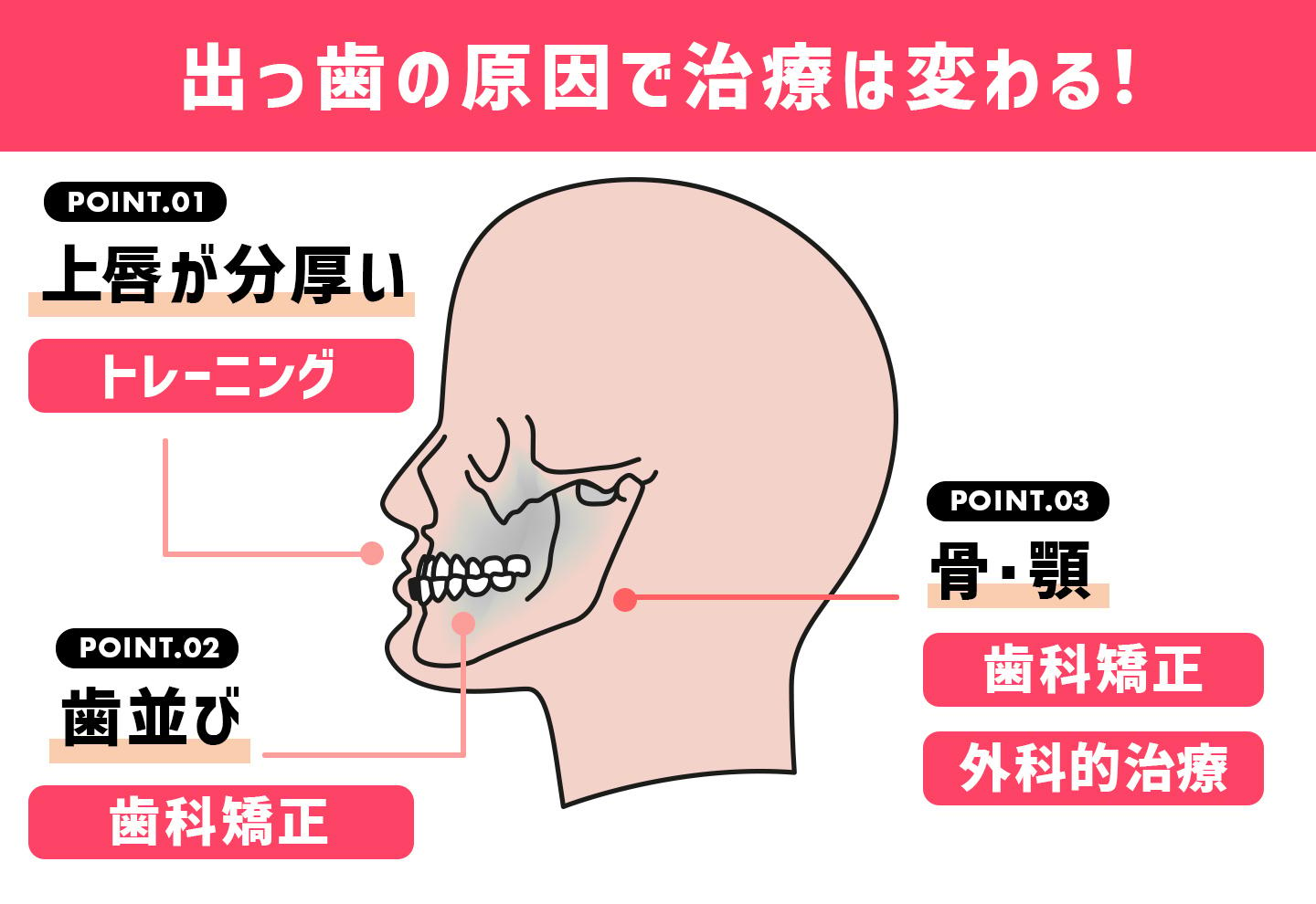 原因と種類の分類