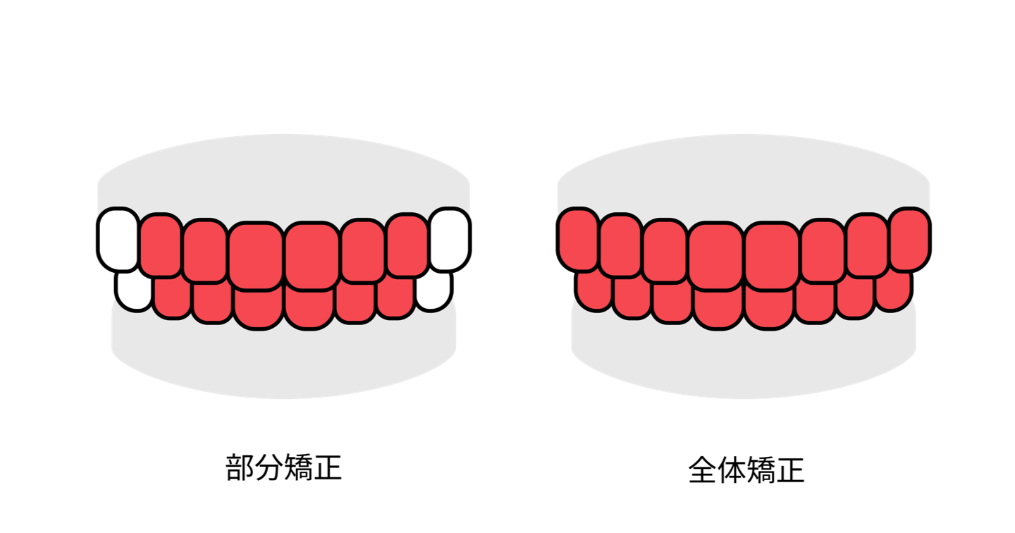 部分と全体の比較画像