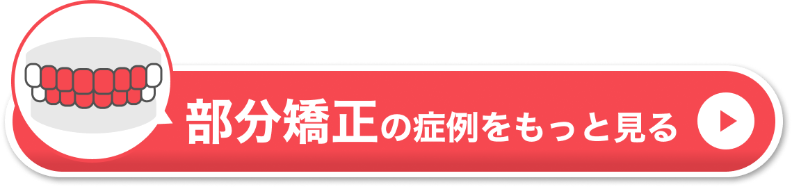 部分矯正の症例をもっと見る