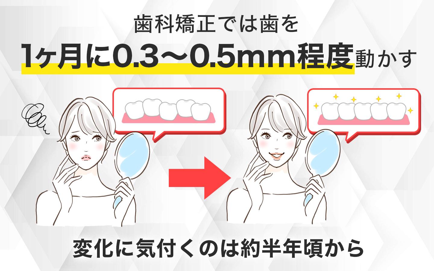 歯列矯正は1ヶ月で0.3～0.5mm程度歯が動く