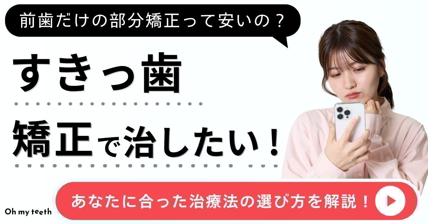 すきっ歯　矯正アイキャッチ