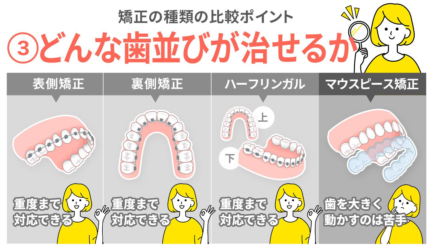 大人の歯科矯正の種類を比較するポイント③どんな歯並びに対応できるか
