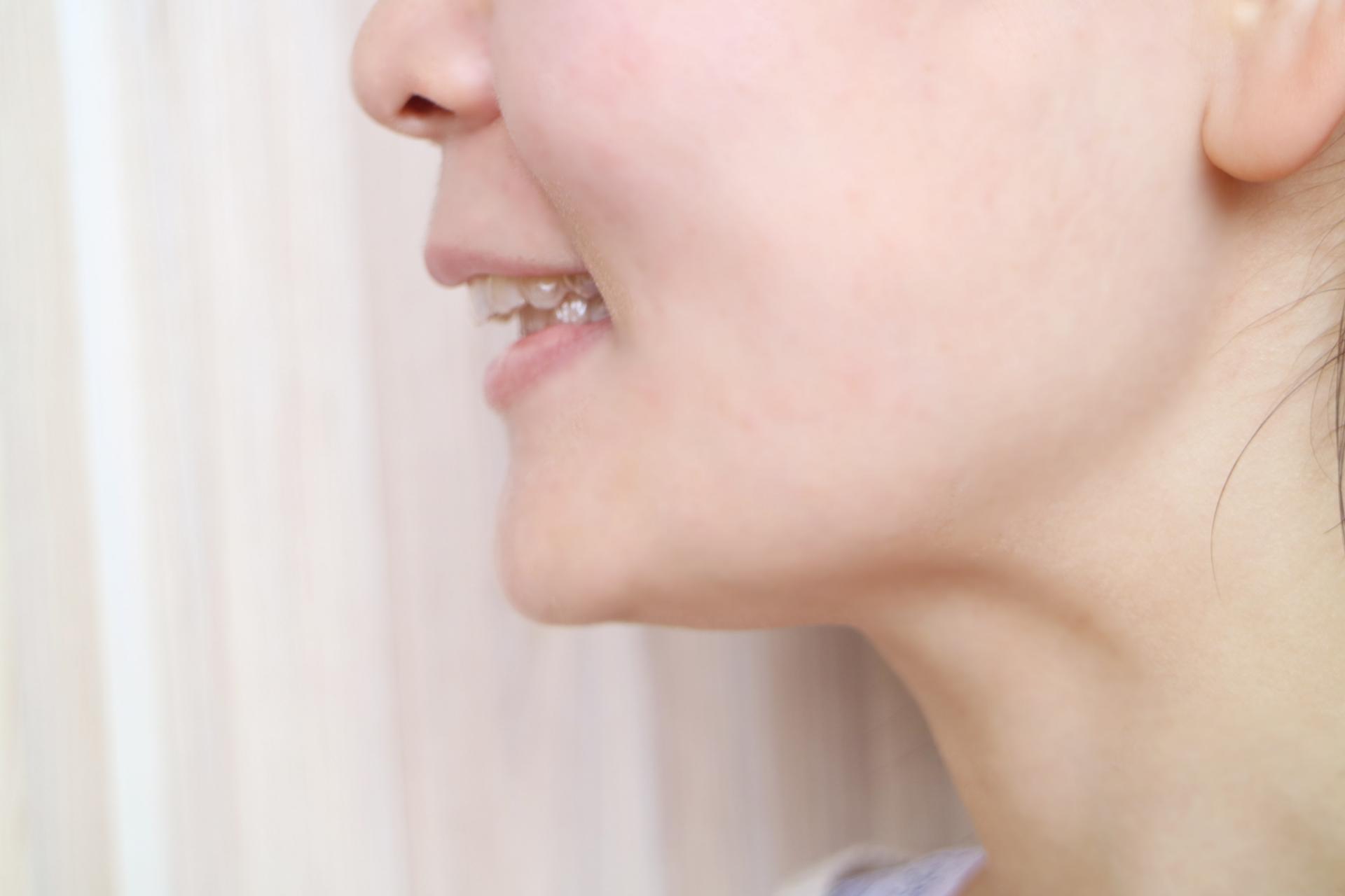 出っ歯を自力で治す方法は存在しない!自力矯正をする前に知るべきリスク