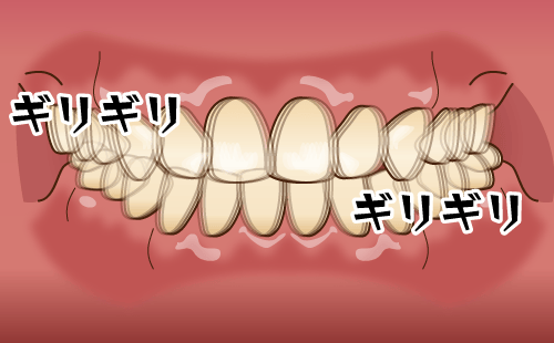 噛み合わせと肩こりの関係性や予防法を解説【歯科医師監修】