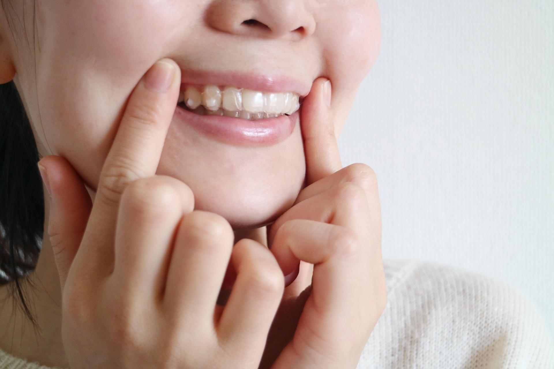 歯列矯正で歯を動かしやすくする方法
