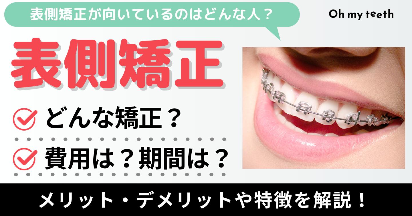 表側矯正　アイキャッチ