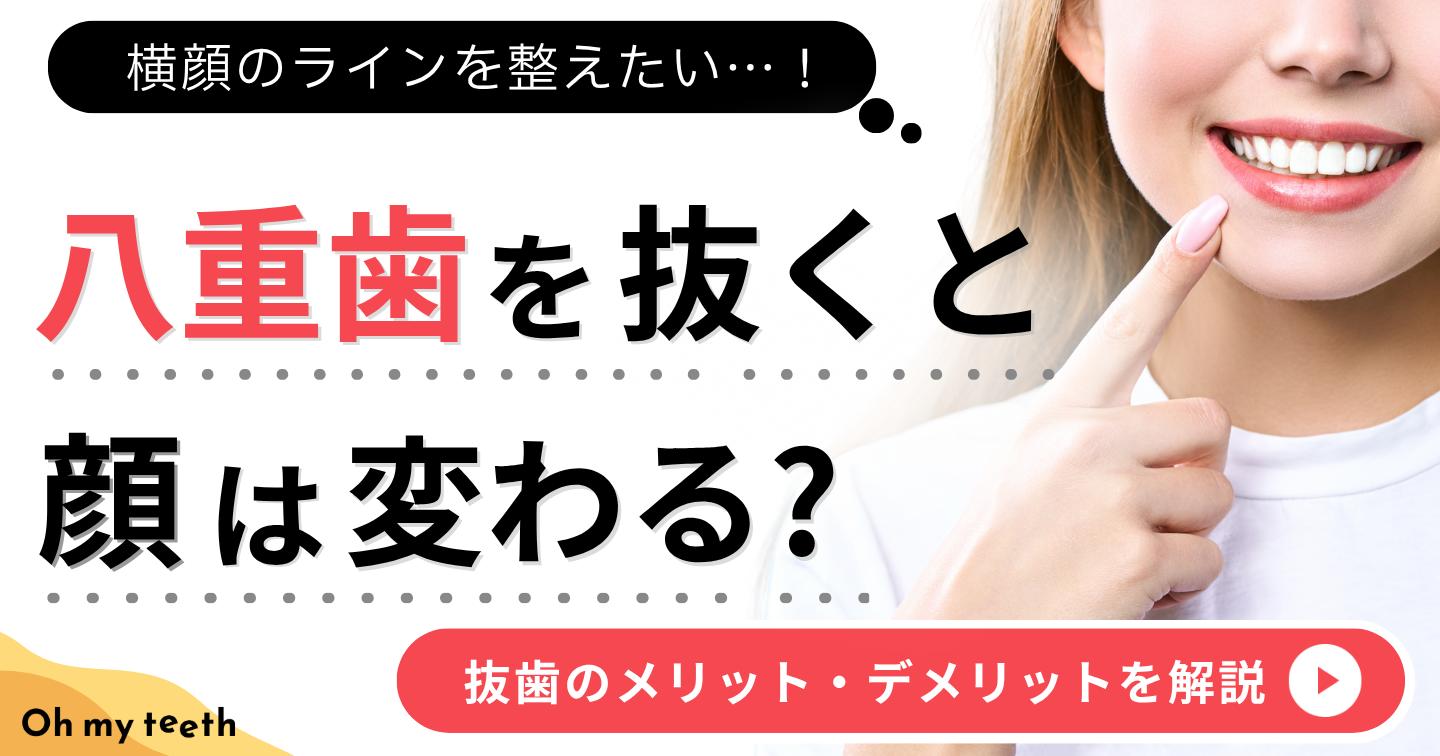 八重歯 を抜くと　アイキャッチ