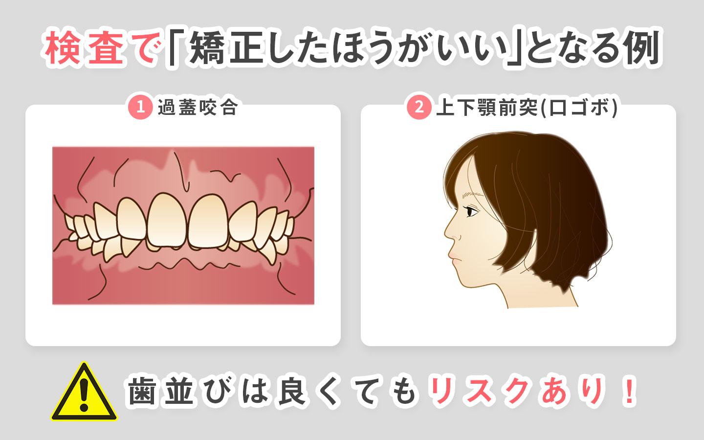 リスク2種類