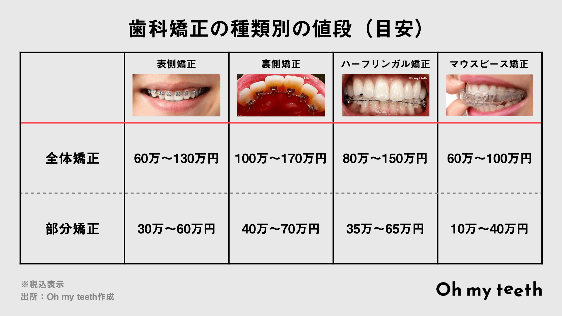 歯科矯正の種類別の値段