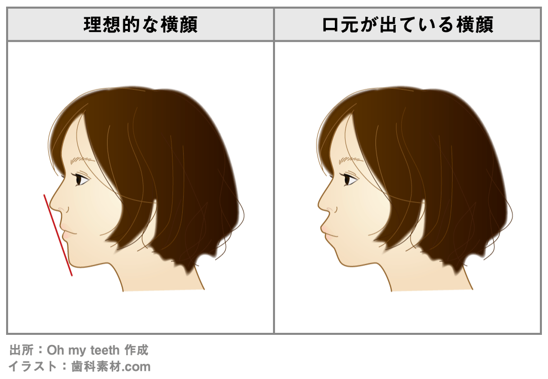 理想的な横顔と口元が出ている横顔