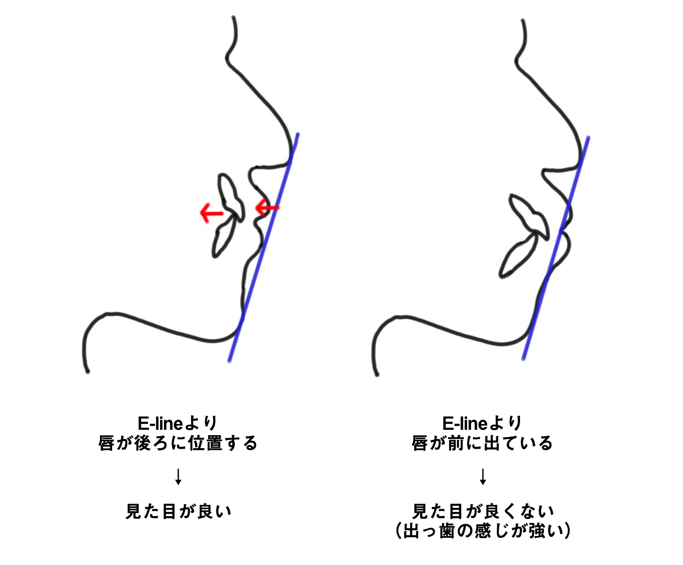 Eラインの説明画像