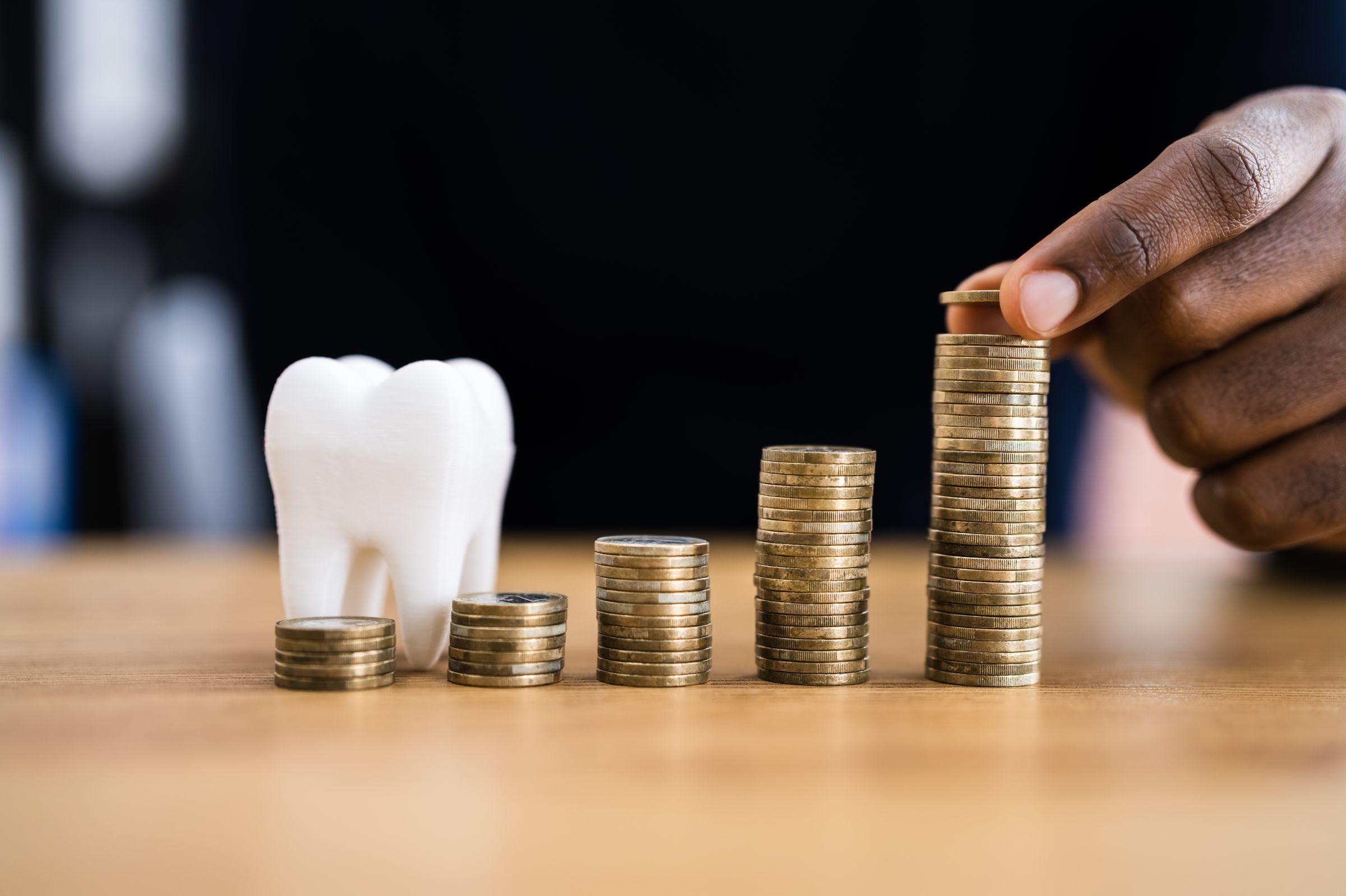 歯科治療費のイメージ