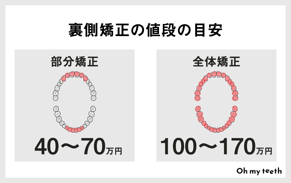 裏側矯正の値段の目安