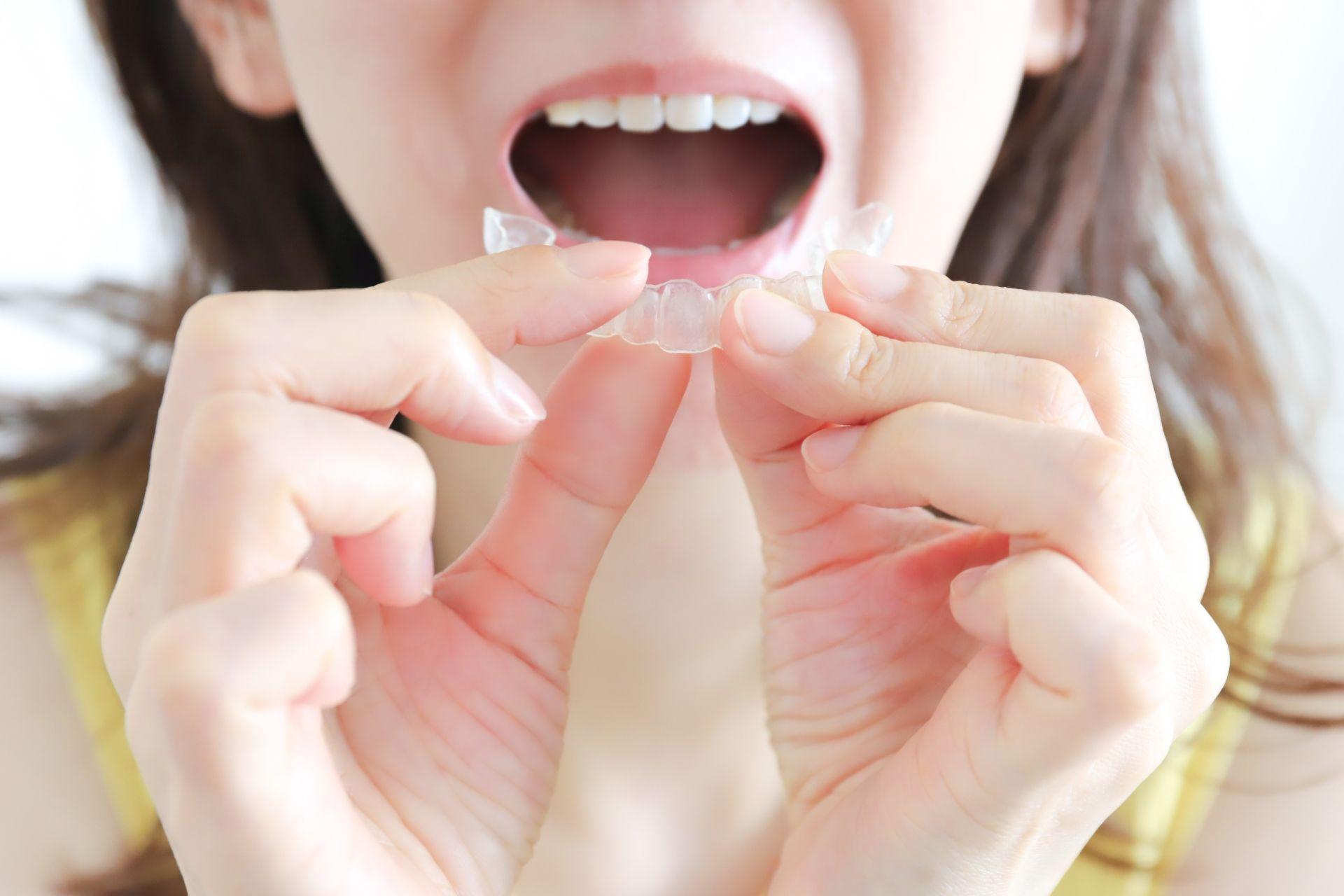 噛み合わせが深いのはマウスピース矯正で治せる?原因や治療法を解説
