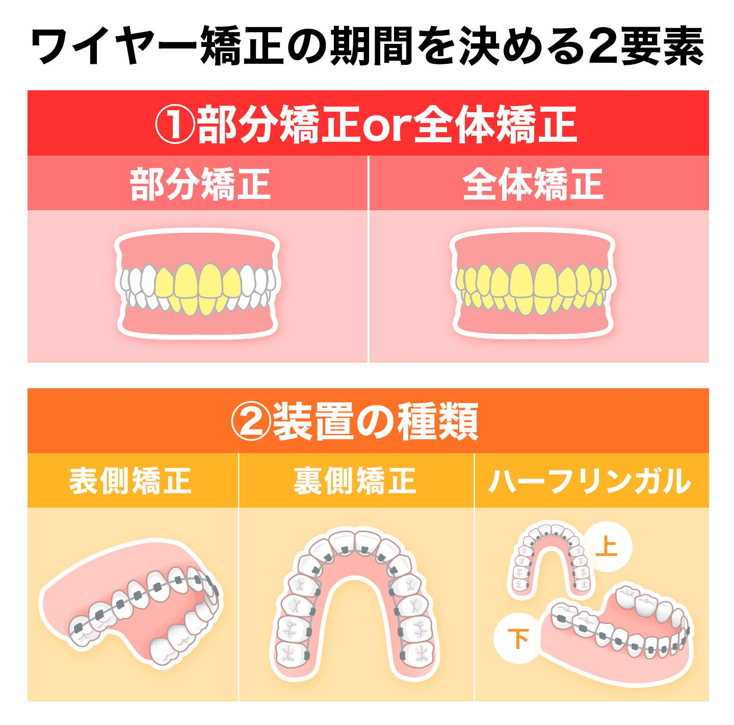 ワイヤー期間 要素