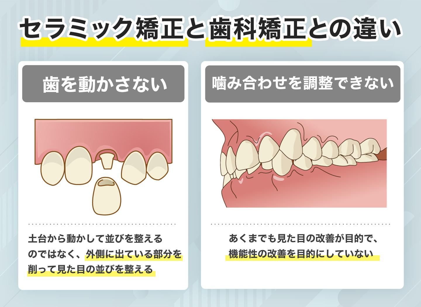 セラミック矯正と歯科矯正との違い