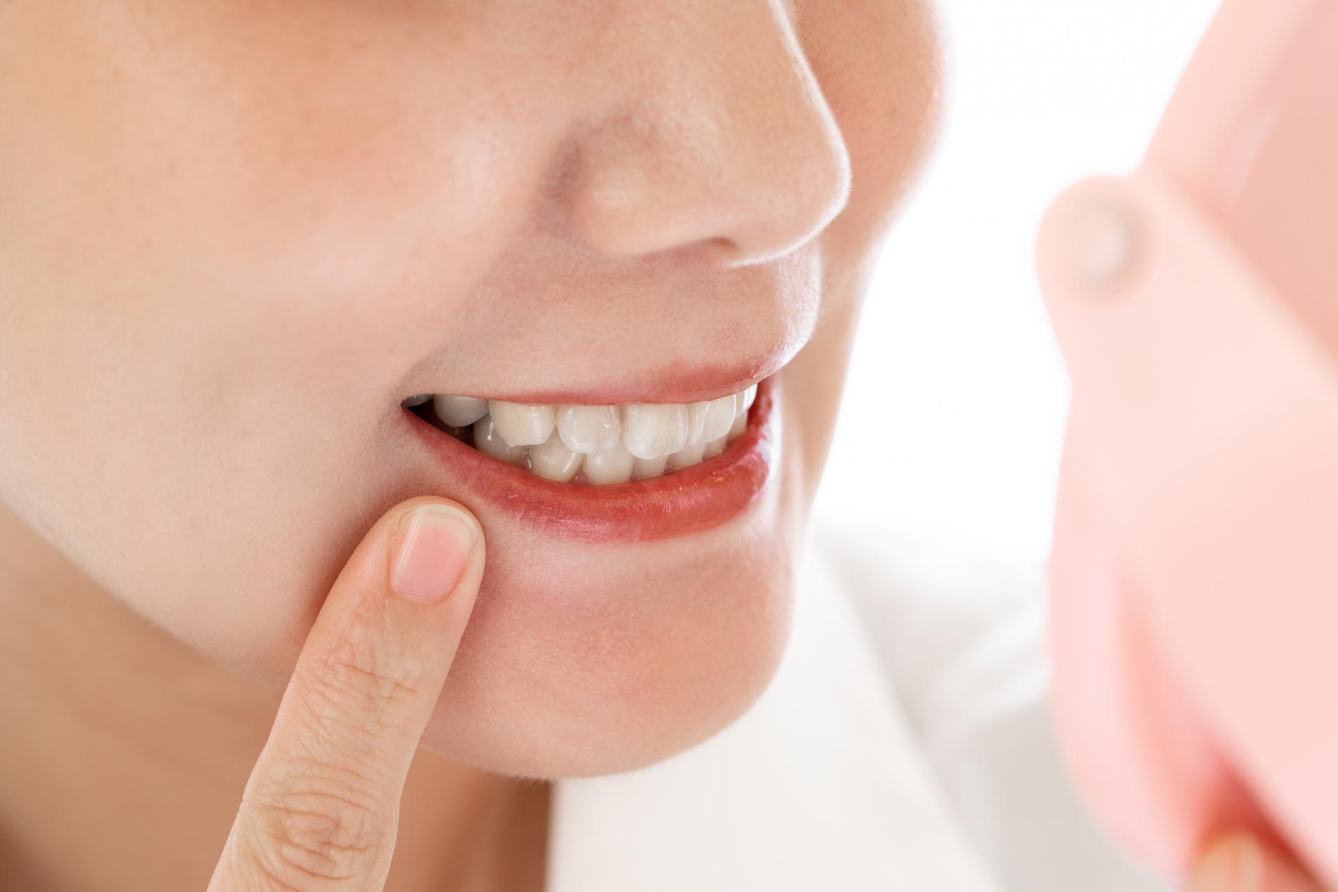 前歯の部分矯正で適応できる症例