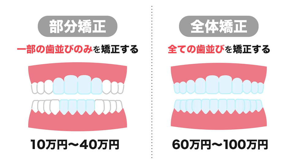 部分と全体で違うマウスピース矯正の値段