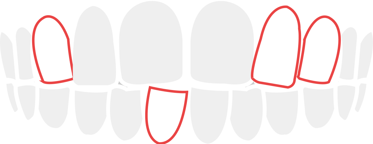 gatagata