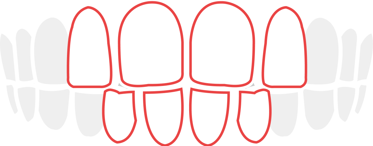 sukippa