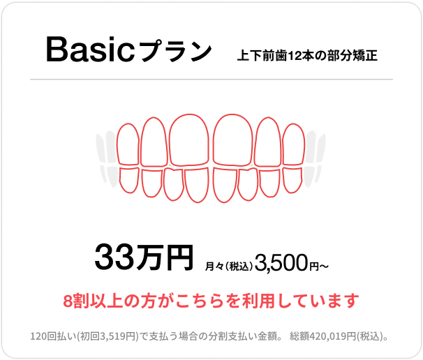 Basicプラン、上下前歯12本の部分矯正、33万円、月々（税込）3,500円〜