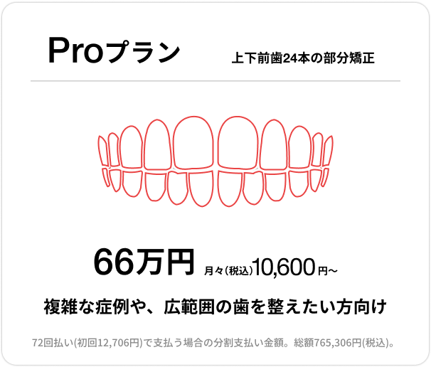 Proプラン、上下前歯24本の部分矯正、66万円、月々（税込）10,600円〜