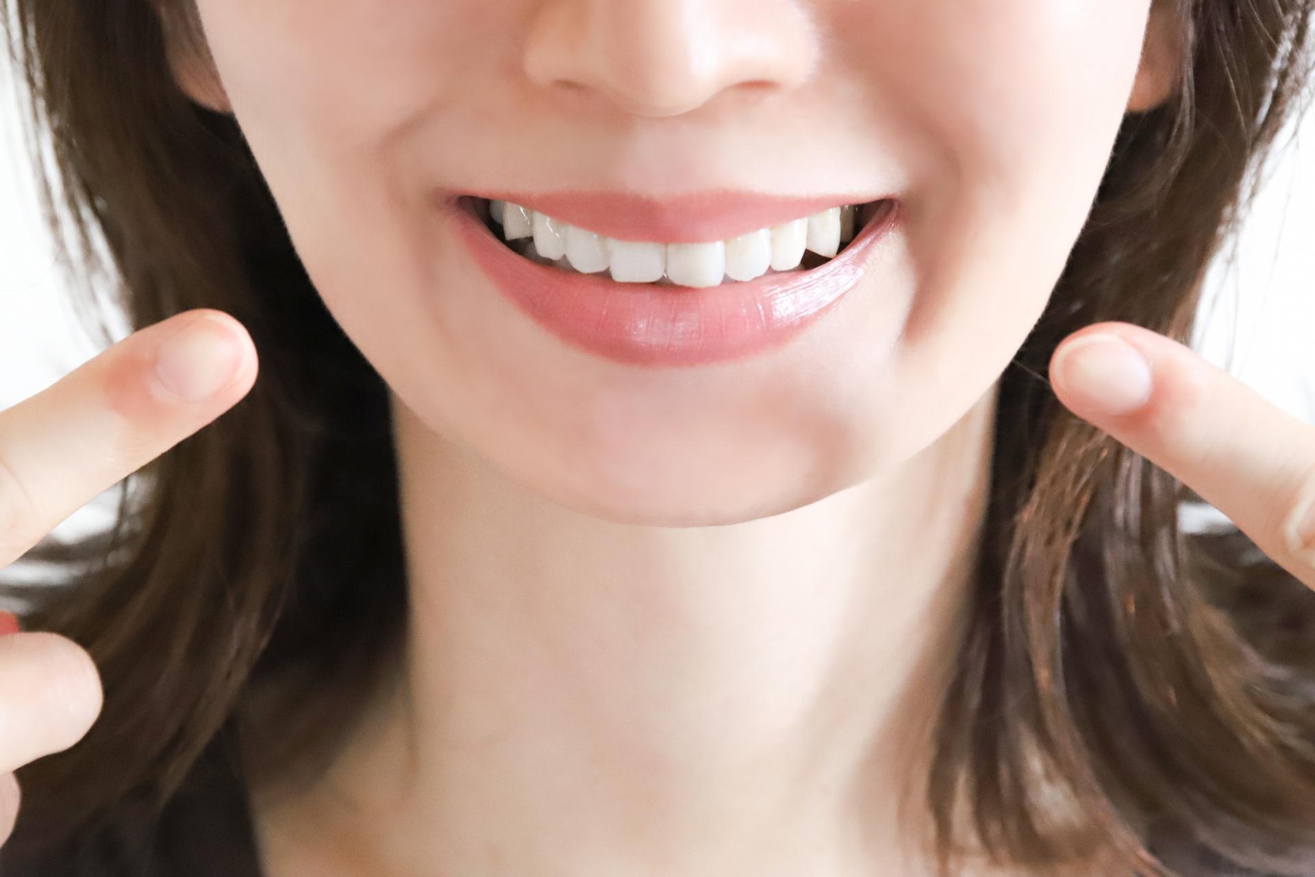 ダイレクトボンディングとは?