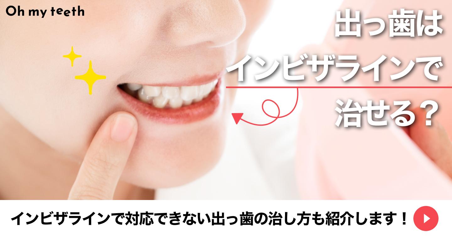 カバー(出っ歯はインビザライン矯正で治せる?)