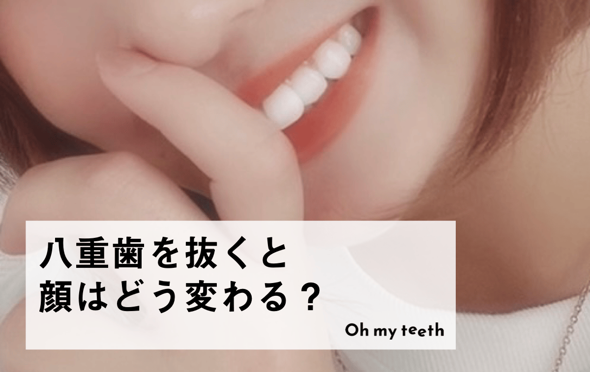 八重歯を抜くと顔はどう変わる?