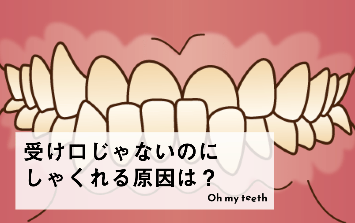 受け口じゃないのにしゃくれる原因は?