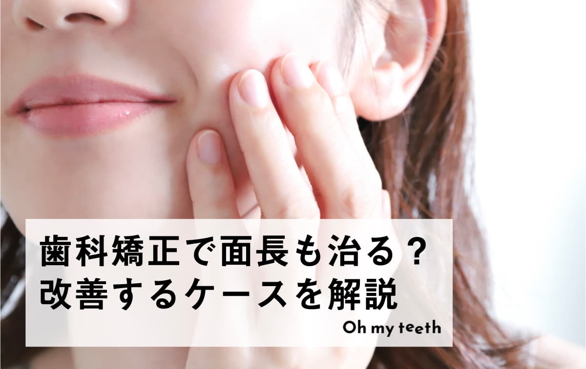 歯科矯正で面長は治る?