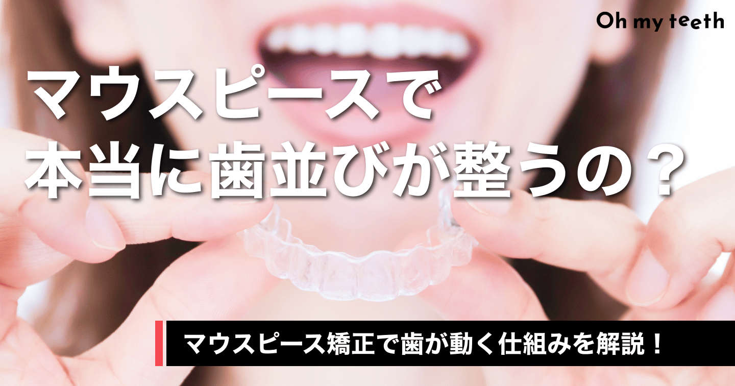 マウスピース矯正の仕組みを歯科医師が徹底解説!なぜ歯が動くの?