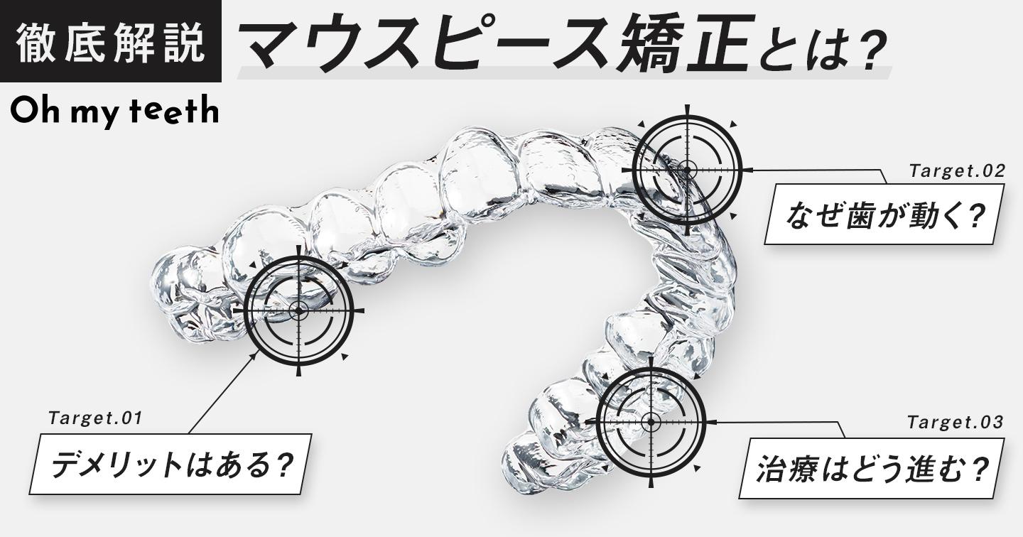 マウスピース矯正とは?徹底解説