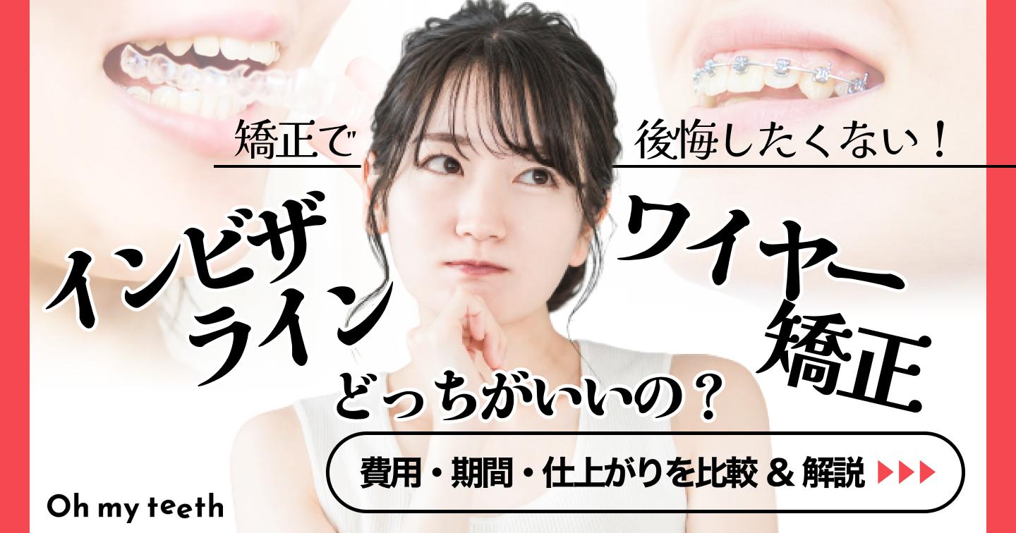インビザラインとワイヤー矯正どっちがいい?