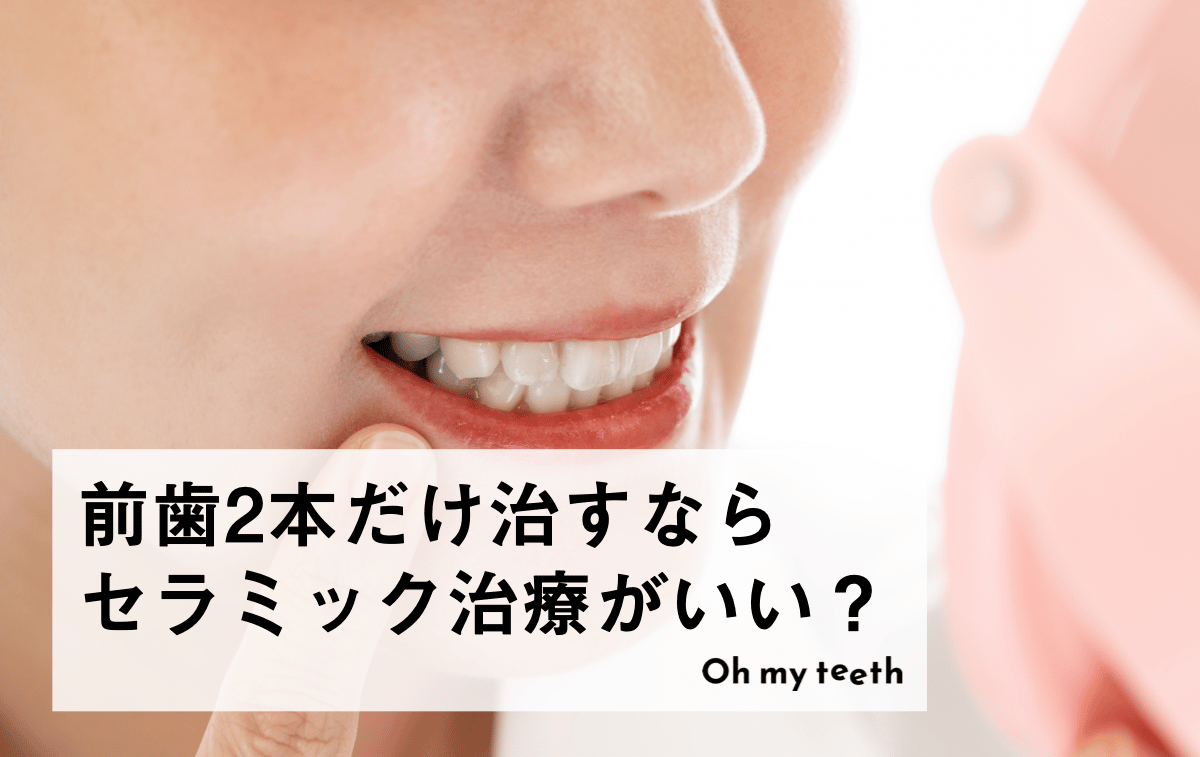 前歯2本だけならセラミック治療で治せる?