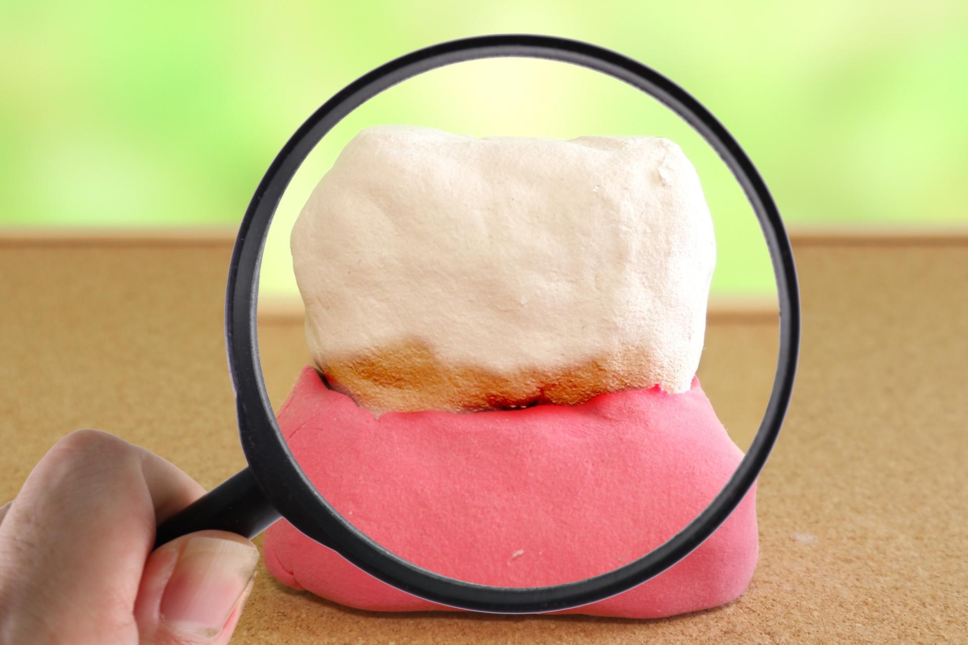 ホームホワイトニングで根元の黄ばみは改善できる?原因別に効果を解説