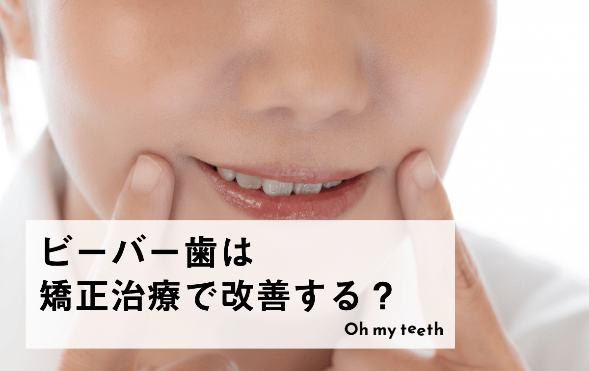 ビーバー歯は矯正でなおる?