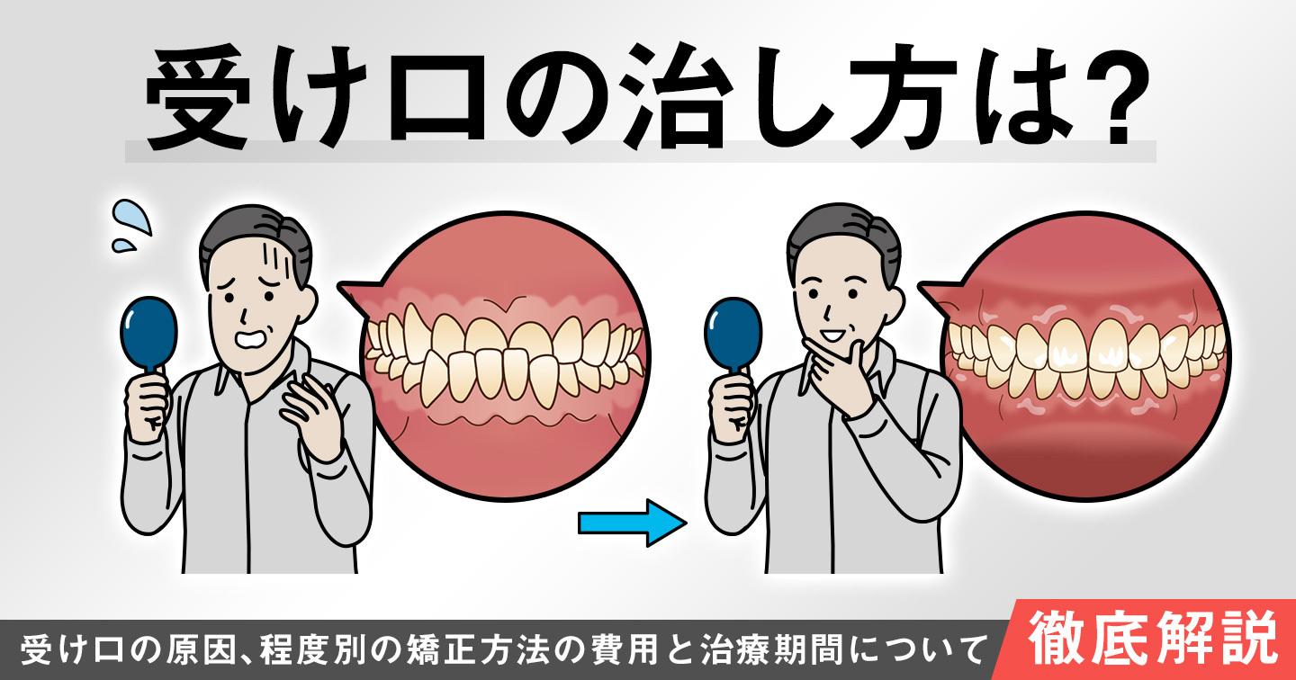 受け口 治し方