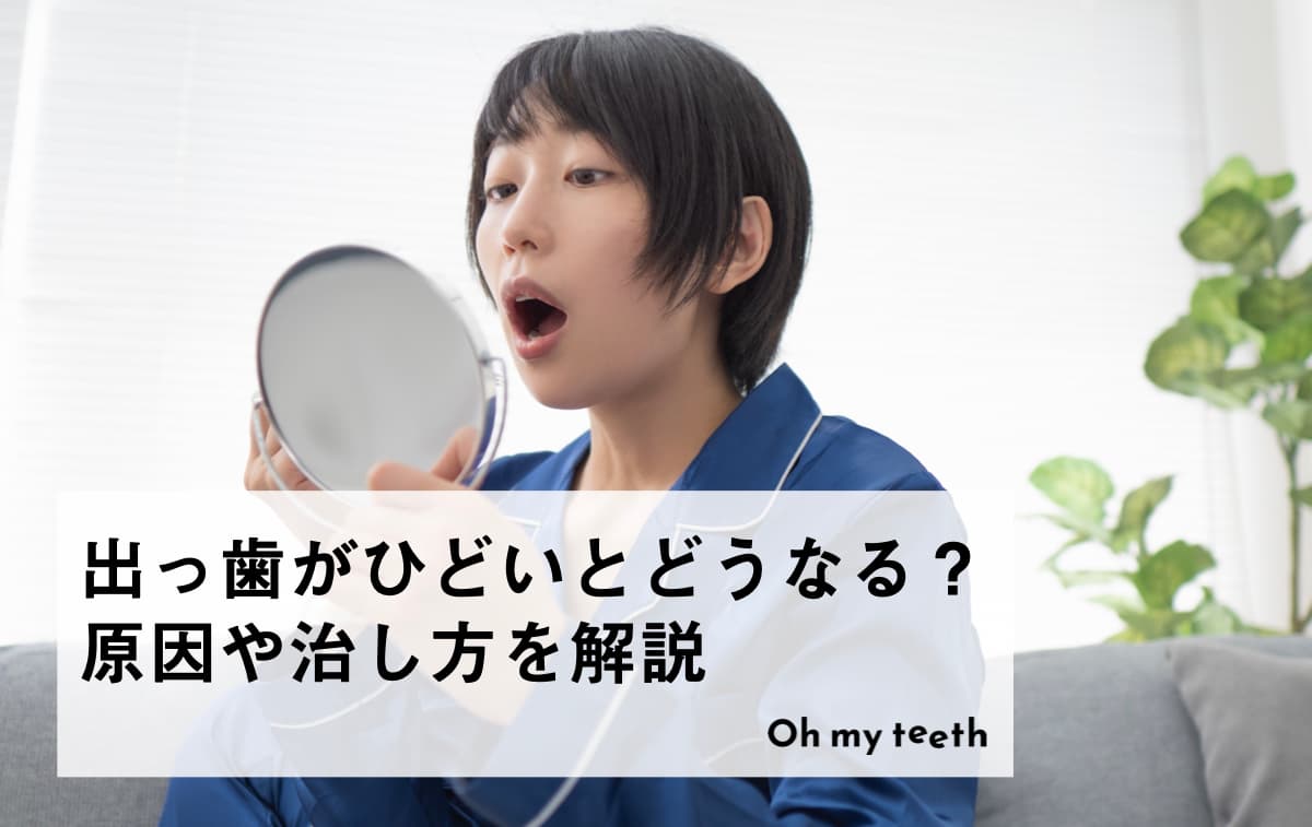 出っ歯がひどいとどうなる?