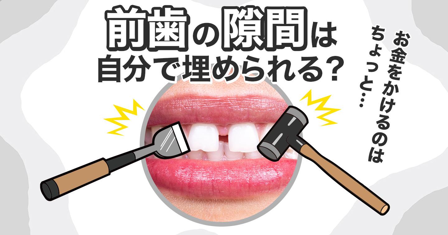 前歯の隙間は自分で埋められるtop